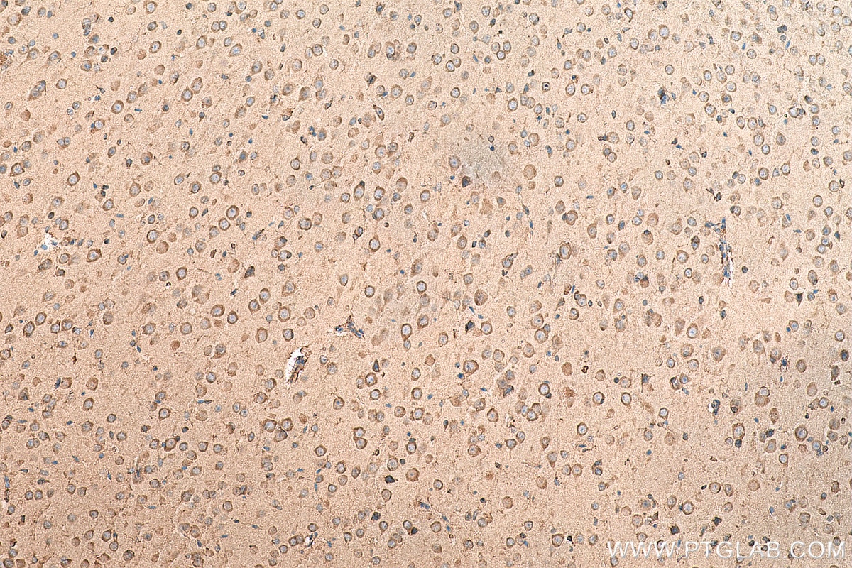 Immunohistochemistry (IHC) staining of mouse brain tissue using EEF1A1 Polyclonal antibody (11402-1-AP)