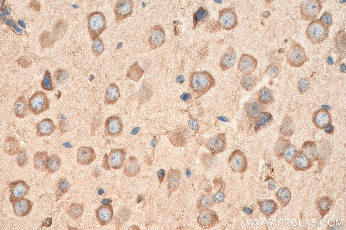 IHC staining of mouse brain using 11402-1-AP