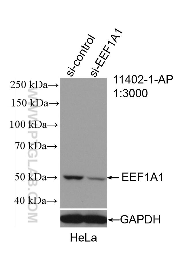 Western Blot (WB) analysis of HeLa cells using EEF1A1 Polyclonal antibody (11402-1-AP)