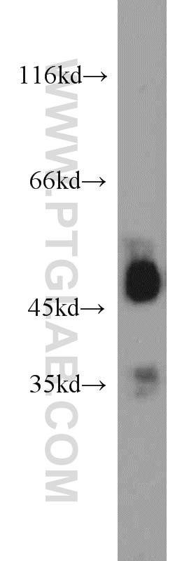 Western Blot (WB) analysis of mouse pancreas tissue using EEF1A1 Polyclonal antibody (11402-1-AP)