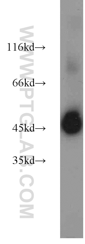 WB analysis of mouse skeletal muscle using 11402-1-AP