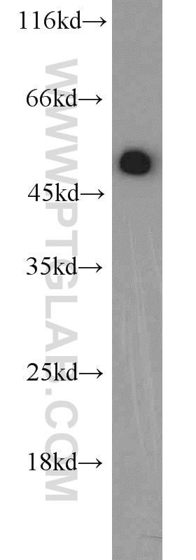 Western Blot (WB) analysis of rat brain tissue using EEF1A1 Polyclonal antibody (11402-1-AP)