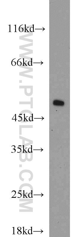 Western Blot (WB) analysis of human brain tissue using EEF1A1 Polyclonal antibody (11402-1-AP)