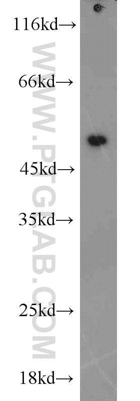 Western Blot (WB) analysis of Jurkat cells using EEF1A1 Polyclonal antibody (11402-1-AP)