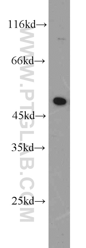 Western Blot (WB) analysis of SH-SY5Y cells using EEF1A1 Polyclonal antibody (11402-1-AP)