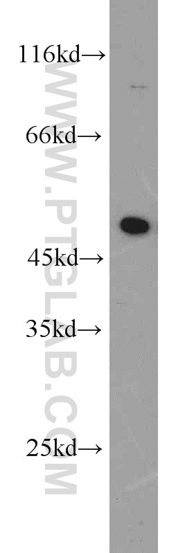 WB analysis of SH-SY5Y using 11402-1-AP