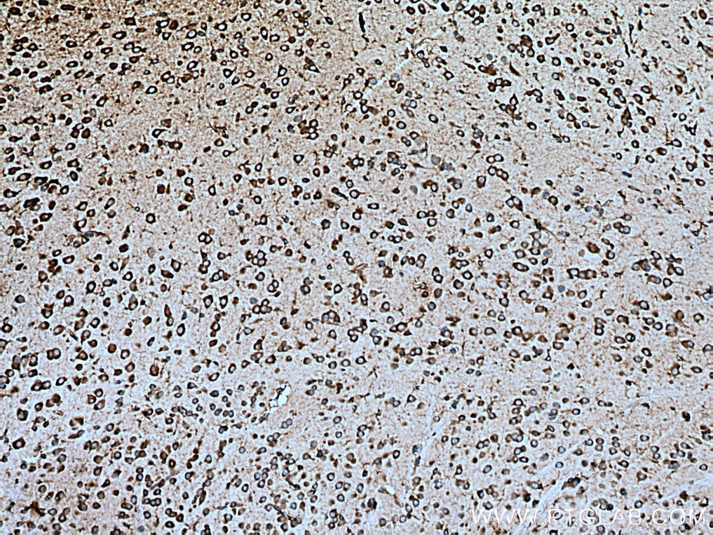 Immunohistochemistry (IHC) staining of mouse brain tissue using EEF1A1 Monoclonal antibody (67495-1-Ig)