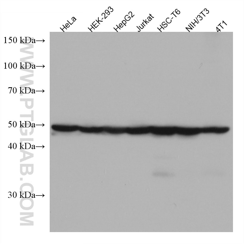 EEF1A1