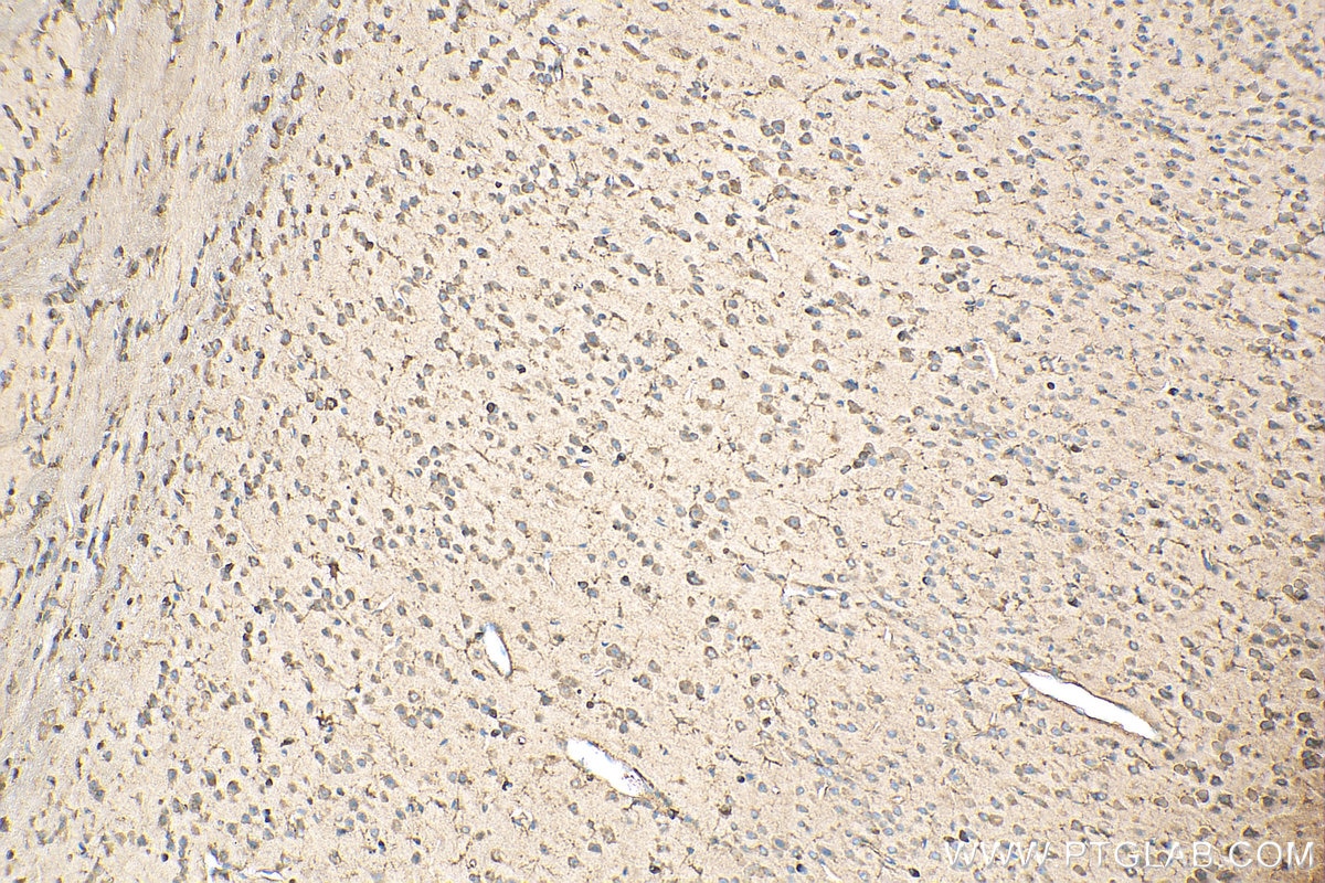 Immunohistochemistry (IHC) staining of mouse brain tissue using EEF1A1 Recombinant antibody (81377-1-RR)