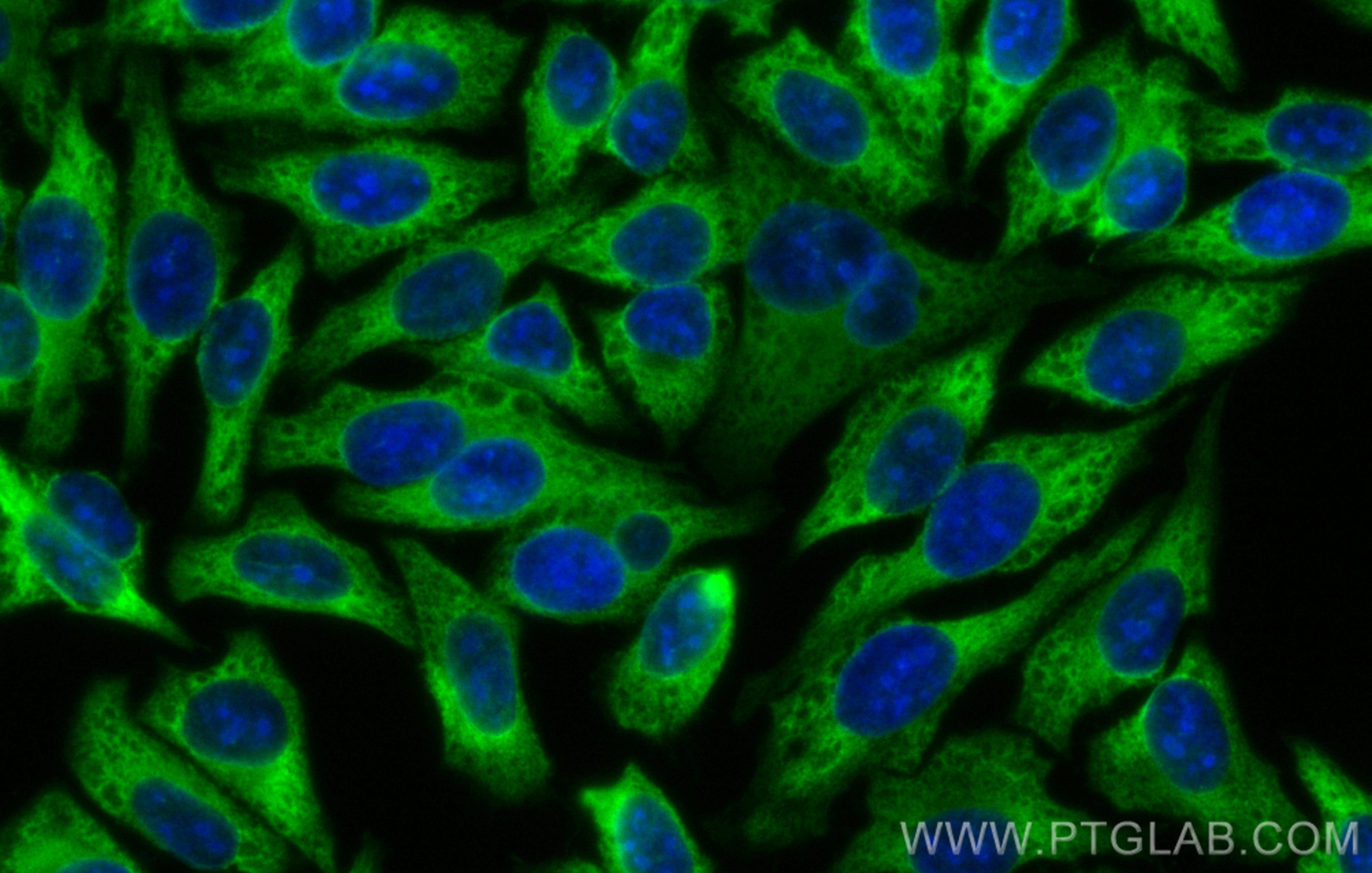 Immunofluorescence (IF) / fluorescent staining of HepG2 cells using CoraLite® Plus 488-conjugated EEF1A1 Recombinant a (CL488-81377)