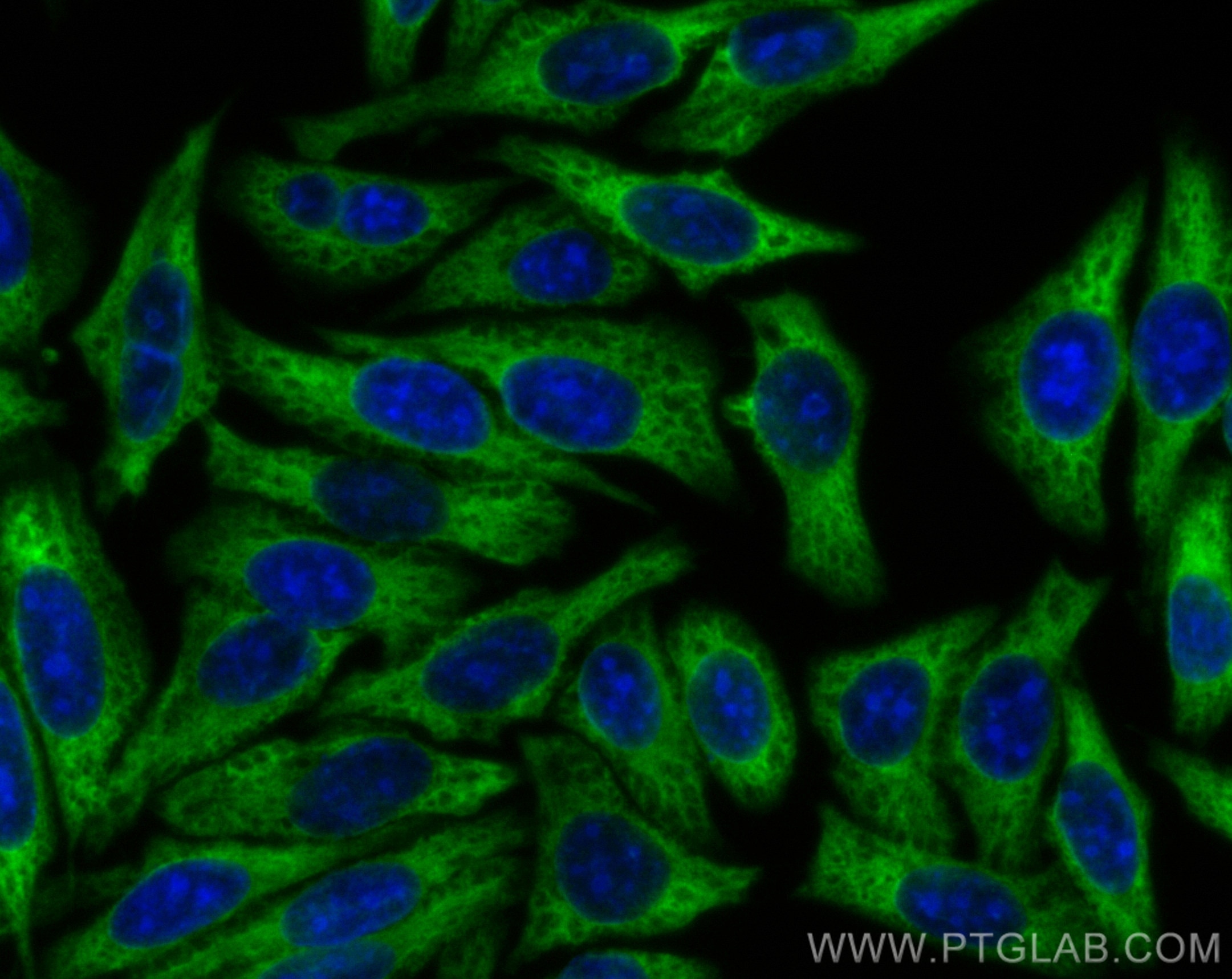 IF Staining of HepG2 using CL488-81377