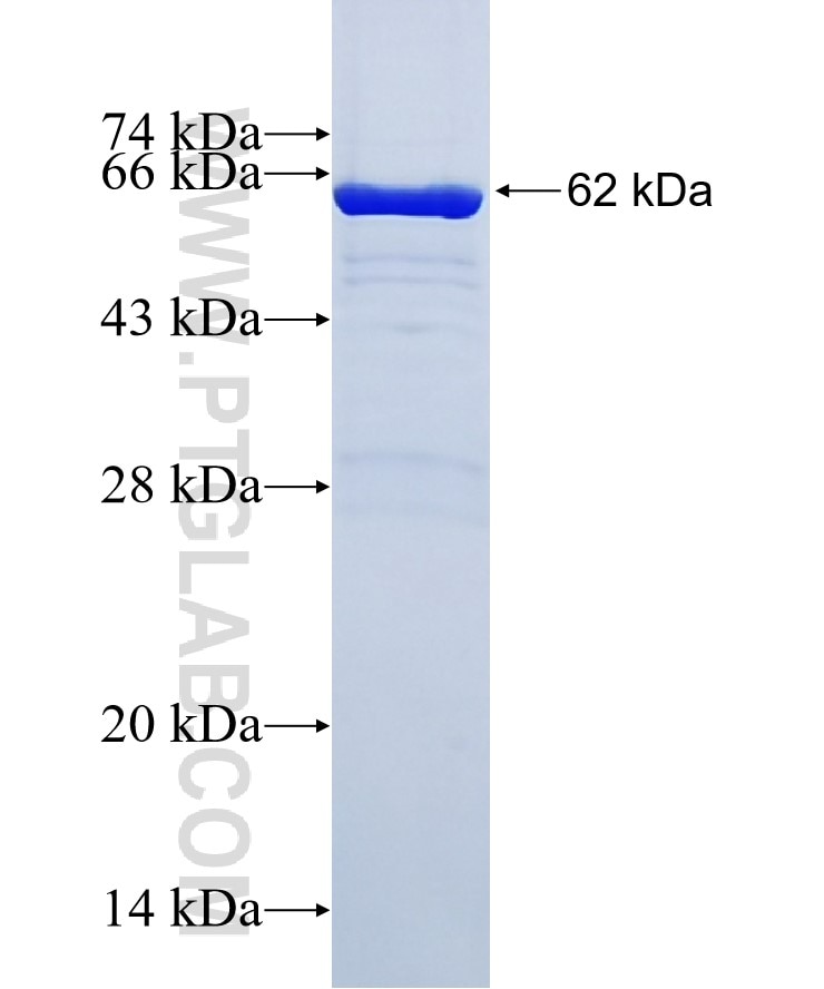 EEF1A1 fusion protein Ag1938 SDS-PAGE