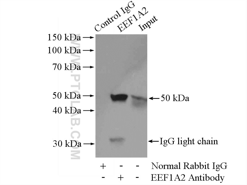 Immunoprecipitation (IP) experiment of mouse brain tissue using EEF1A2 Polyclonal antibody (16091-1-AP)
