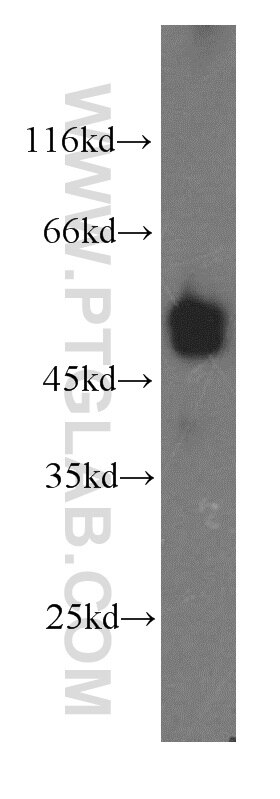 Western Blot (WB) analysis of human brain tissue using EEF1A2 Polyclonal antibody (16091-1-AP)