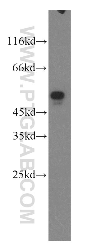 EEF1A2 Polyclonal antibody