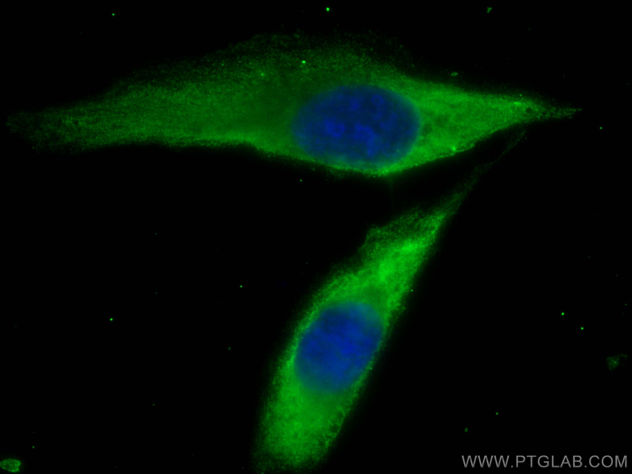 IF Staining of U2OS using CL488-66806