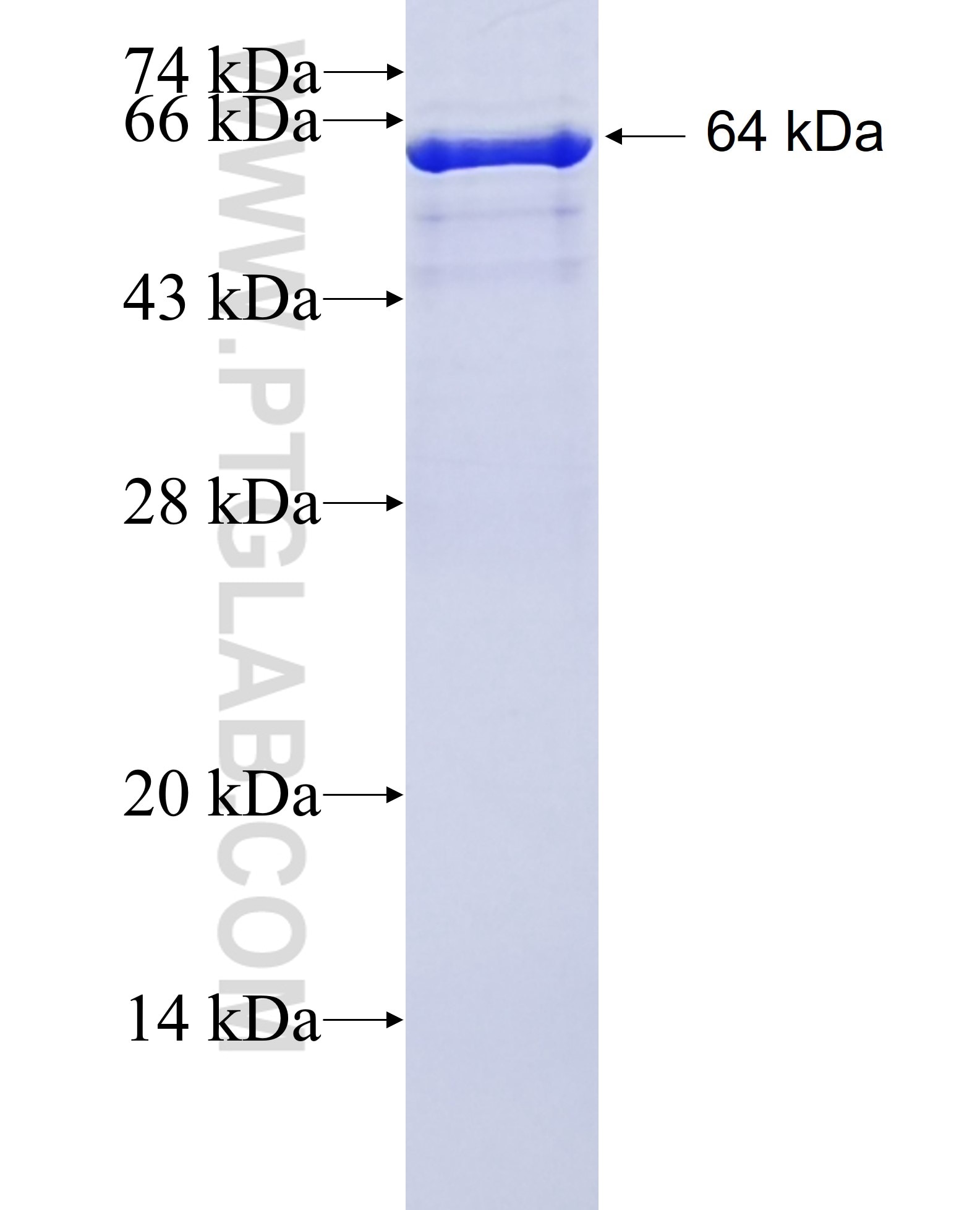 EEF1A2 fusion protein Ag6517 SDS-PAGE