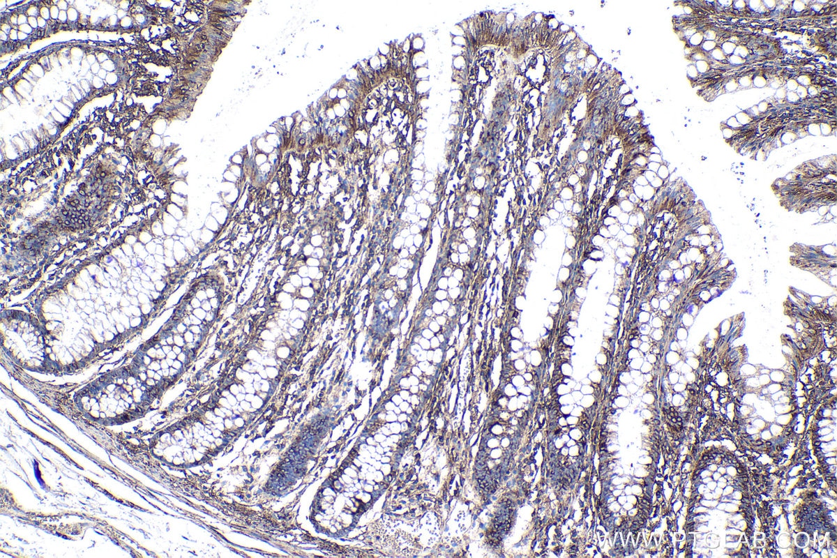 Immunohistochemistry (IHC) staining of human colon tissue using EEF1B2 Polyclonal antibody (10095-2-AP)