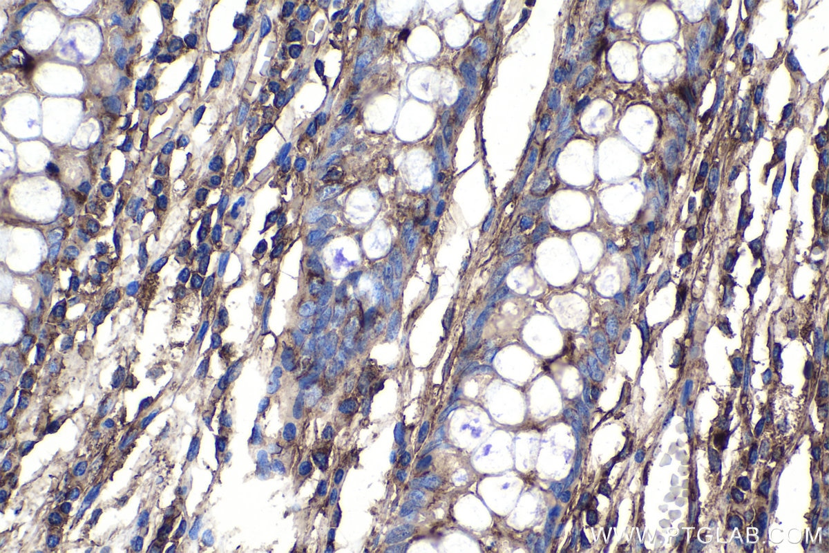 Immunohistochemistry (IHC) staining of human colon tissue using EEF1B2 Polyclonal antibody (10095-2-AP)