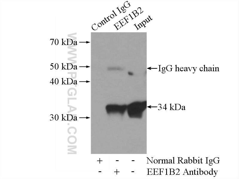 Immunoprecipitation (IP) experiment of Jurkat cells using EEF1B2 Polyclonal antibody (10095-2-AP)