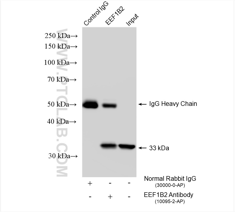 Immunoprecipitation (IP) experiment of Jurkat cells using human EEF1B2 Polyclonal antibody (10095-2-AP)
