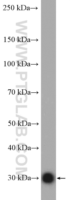 WB analysis of PC-3 using 10095-2-AP