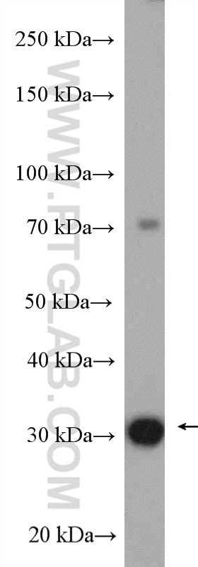 Western Blot (WB) analysis of SKOV-3 cells using EEF1B2 Polyclonal antibody (10095-2-AP)