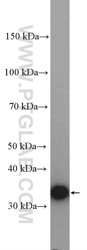 Western Blot (WB) analysis of HeLa cells using EEF1B2 Polyclonal antibody (10095-2-AP)