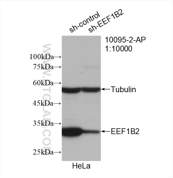 Western Blot (WB) analysis of HeLa cells using EEF1B2 Polyclonal antibody (10095-2-AP)