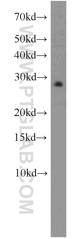 Western Blot (WB) analysis of RAW264.7 using EEF1B2 Polyclonal antibody (10095-2-AP)