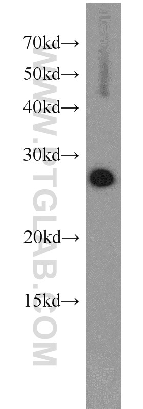 Western Blot (WB) analysis of Jurkat cells using EEF1B2 Polyclonal antibody (10095-2-AP)