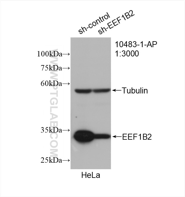 Western Blot (WB) analysis of HeLa cells using EEF1B2 Polyclonal antibody (10483-1-AP)