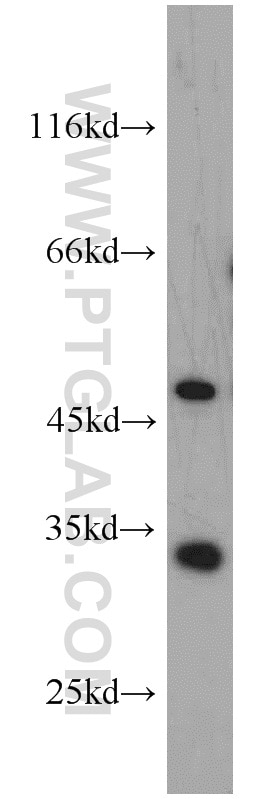 Western Blot (WB) analysis of HEK-293 cells using EEF1B2 Polyclonal antibody (10483-1-AP)