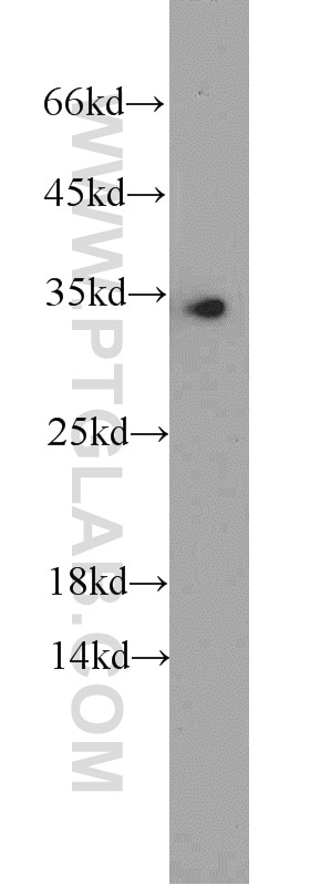 Western Blot (WB) analysis of HeLa cells using EEF1B2 Polyclonal antibody (10483-1-AP)