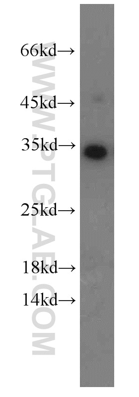 Western Blot (WB) analysis of Jurkat cells using EEF1B2 Polyclonal antibody (10483-1-AP)