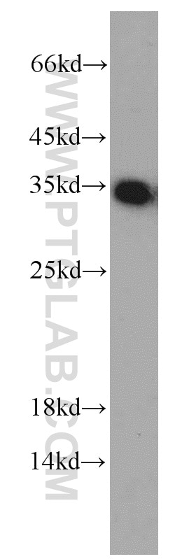 Western Blot (WB) analysis of SKOV-3 cells using EEF1B2 Polyclonal antibody (10483-1-AP)