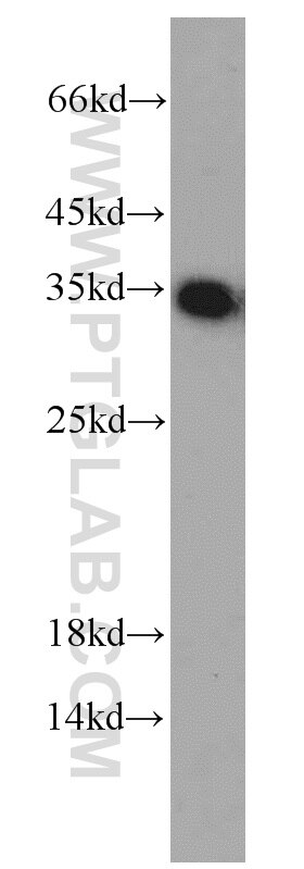 WB analysis of SKOV-3 using 10483-1-AP