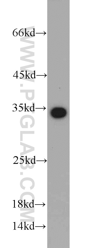 Western Blot (WB) analysis of PC-3 cells using EEF1B2 Polyclonal antibody (10483-1-AP)