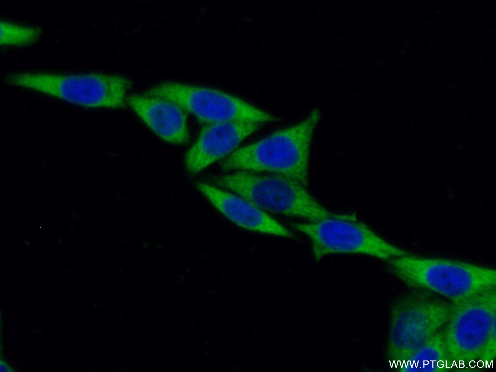 Immunofluorescence (IF) / fluorescent staining of HeLa cells using EEF1B2 Monoclonal antibody (60329-1-Ig)