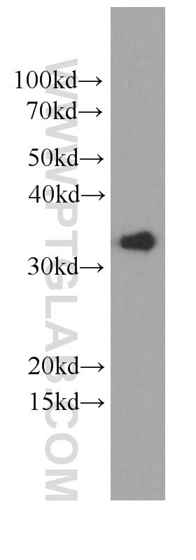 Western Blot (WB) analysis of HeLa cells using EEF1B2 Monoclonal antibody (60329-1-Ig)