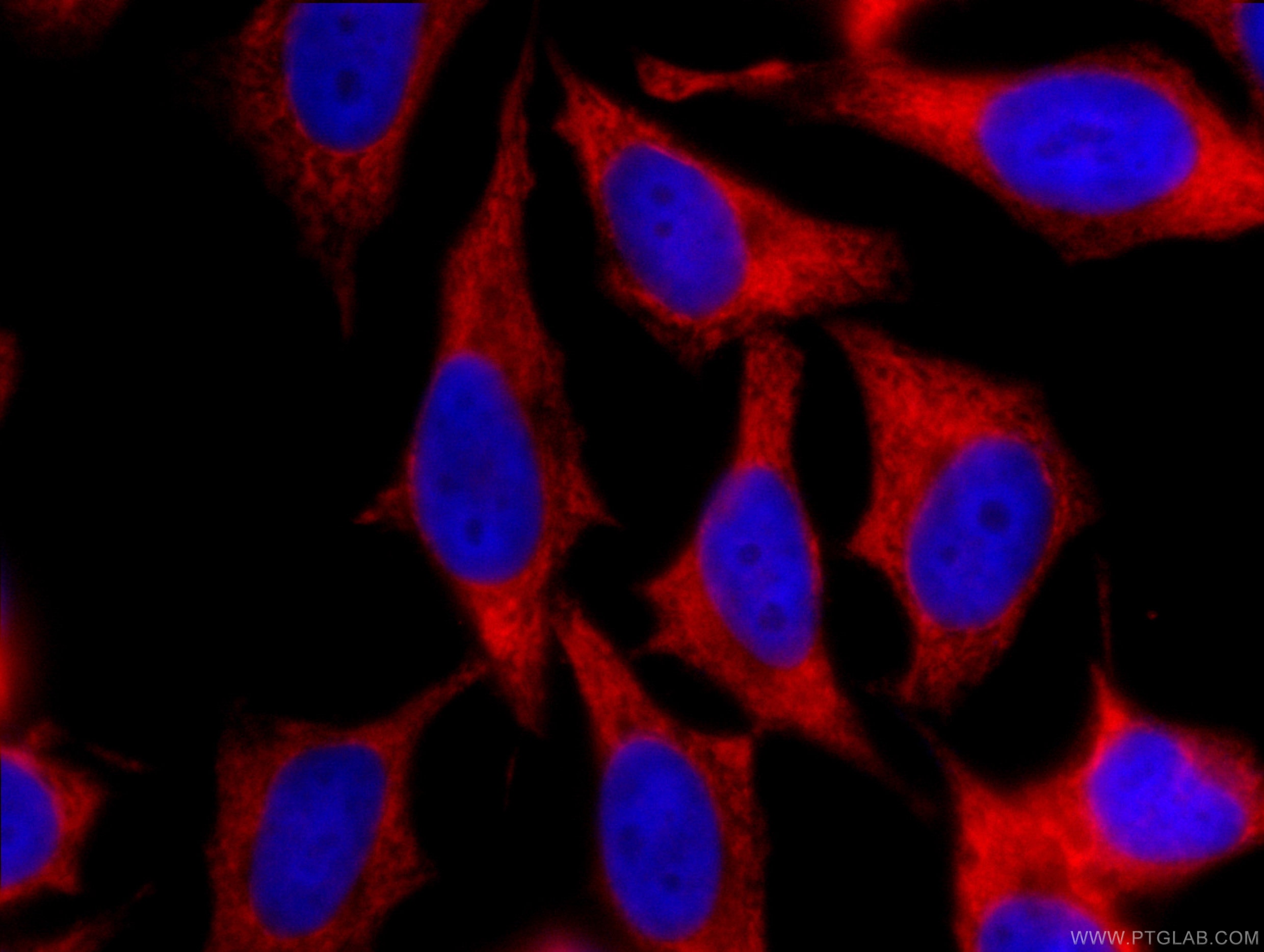 Immunofluorescence (IF) / fluorescent staining of HeLa cells using CoraLite®594-conjugated EEF1B2 Monoclonal antibody (CL594-60329)