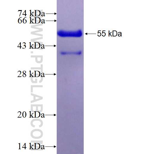 EEF1B2 fusion protein Ag0742 SDS-PAGE
