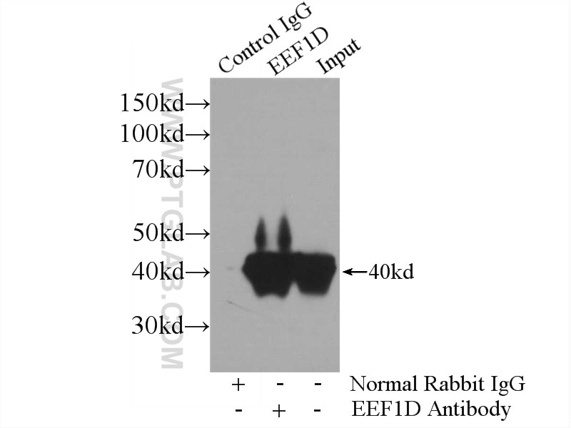 Immunoprecipitation (IP) experiment of HeLa cells using EEF1D Polyclonal antibody (10630-1-AP)