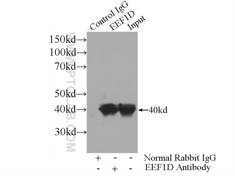 IP experiment of HeLa using 10630-1-AP