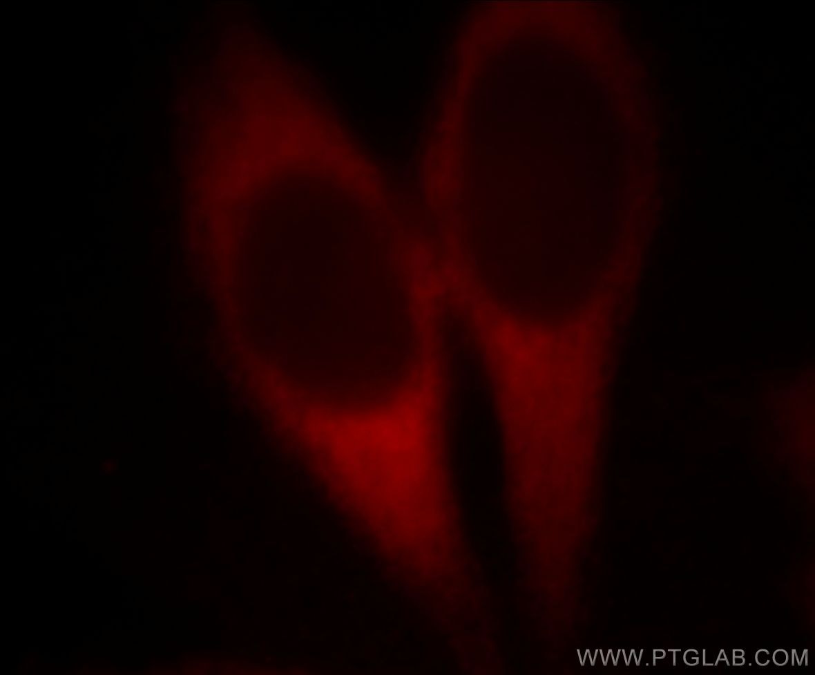 Immunofluorescence (IF) / fluorescent staining of MCF-7 cells using EEF1D Monoclonal antibody (60085-1-Ig)