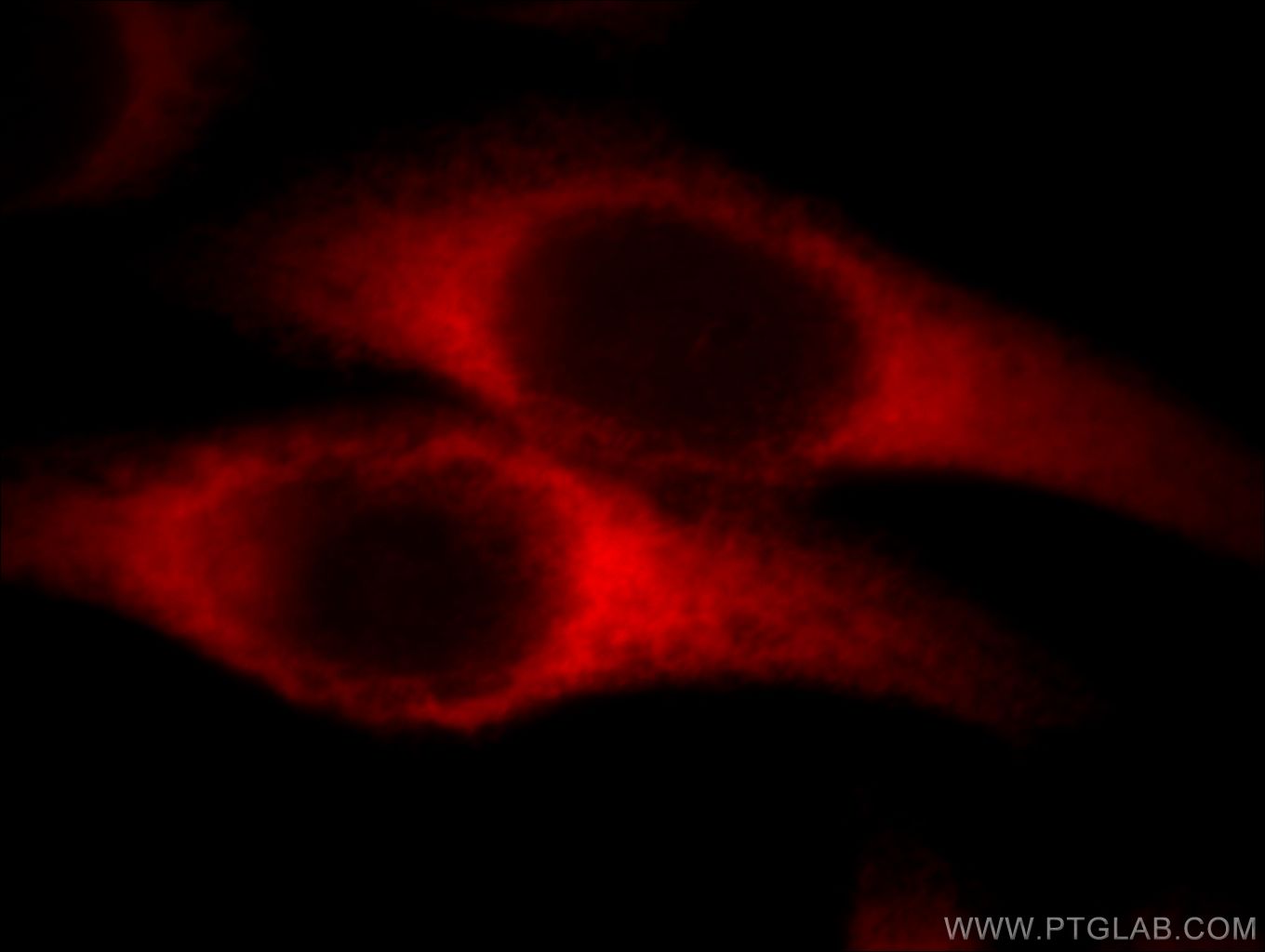 Immunofluorescence (IF) / fluorescent staining of HeLa cells using EEF1D Monoclonal antibody (60085-1-Ig)