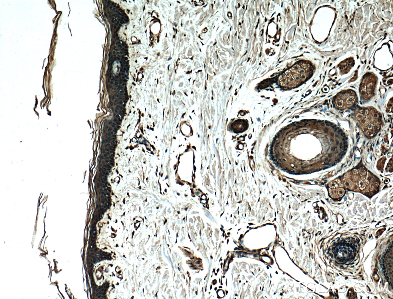 IHC staining of human skin using 60085-1-Ig