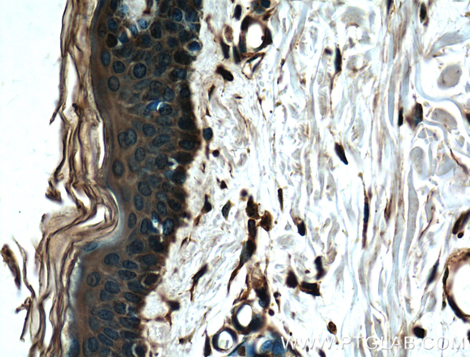 Immunohistochemistry (IHC) staining of human skin tissue using EEF1D Monoclonal antibody (60085-1-Ig)