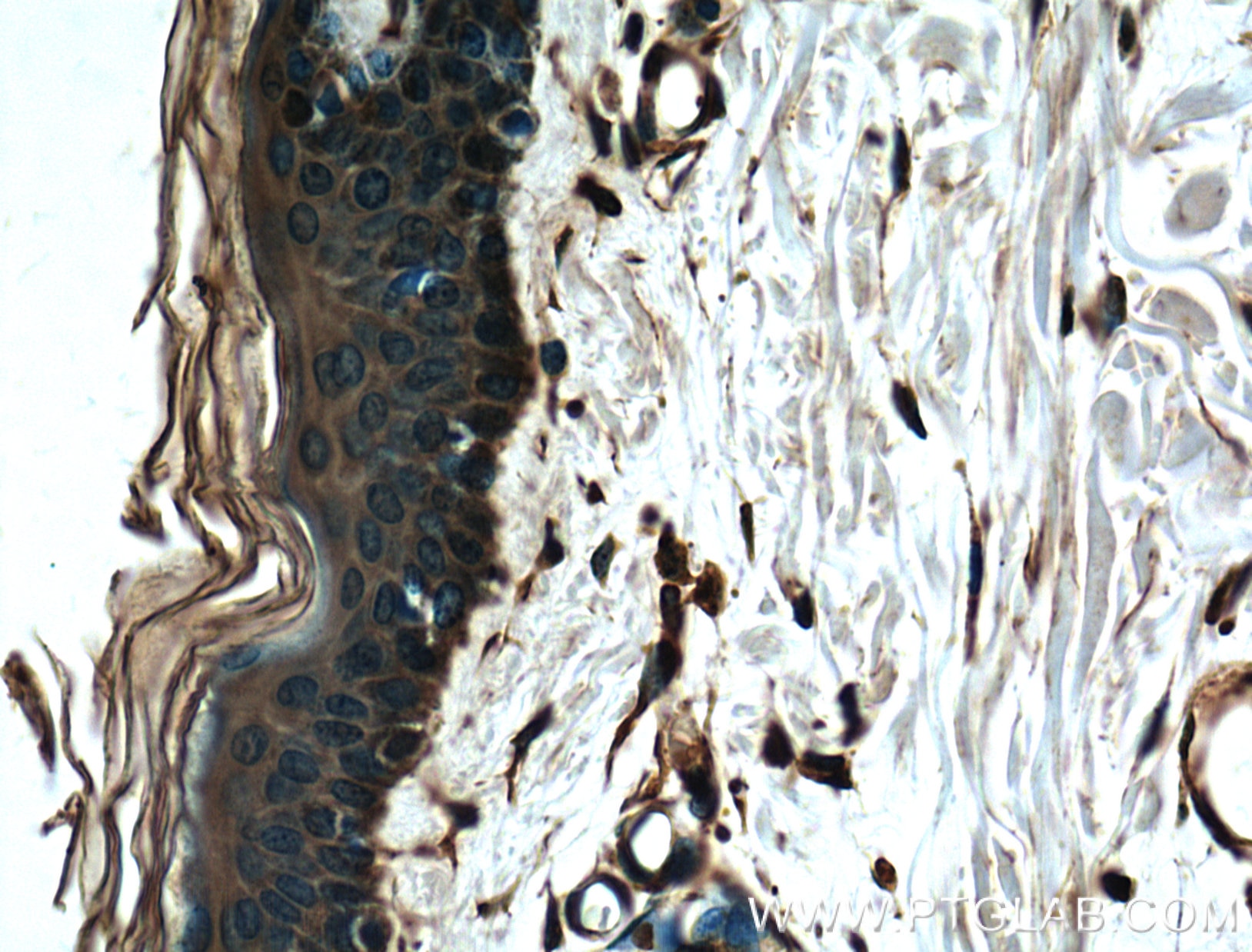 IHC staining of human skin using 60085-1-Ig