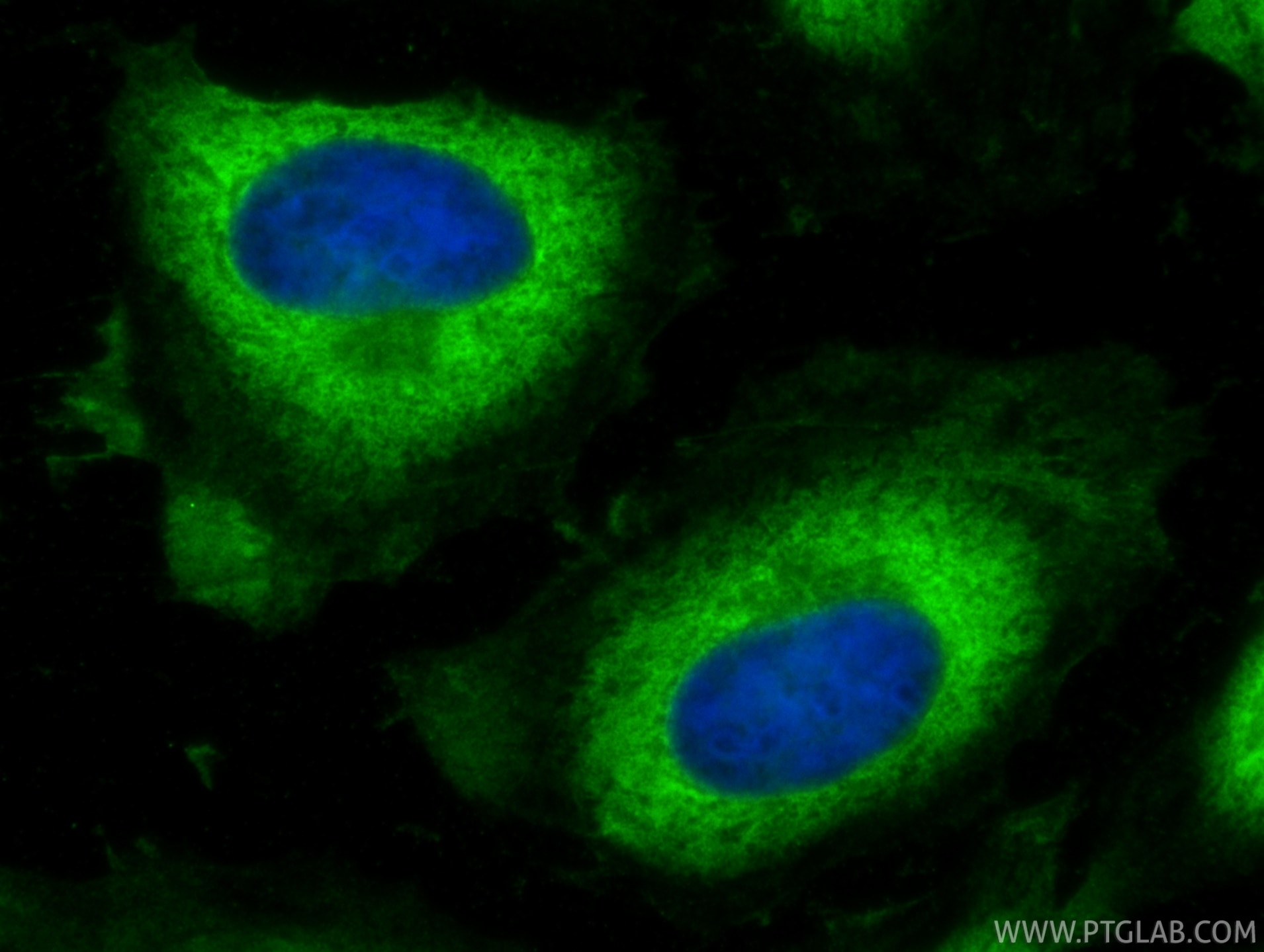 Immunofluorescence (IF) / fluorescent staining of HeLa cells using EEF1D Monoclonal antibody (60085-2-Ig)